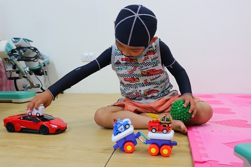 一位小男生頭跟手臂都穿上色的壓力衣，在玩眼鏡的玩具車